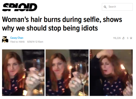 selfie-hair-burns-idiot